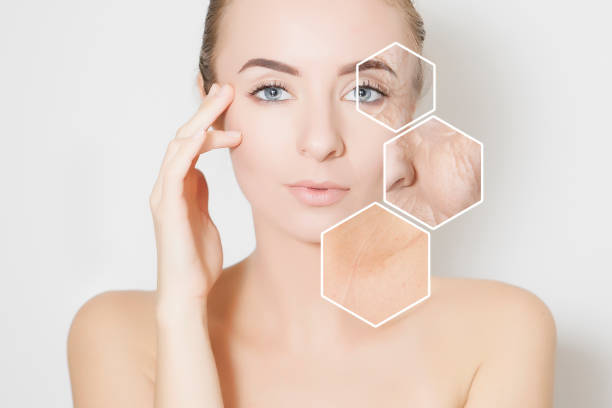 ageing skin blog post
